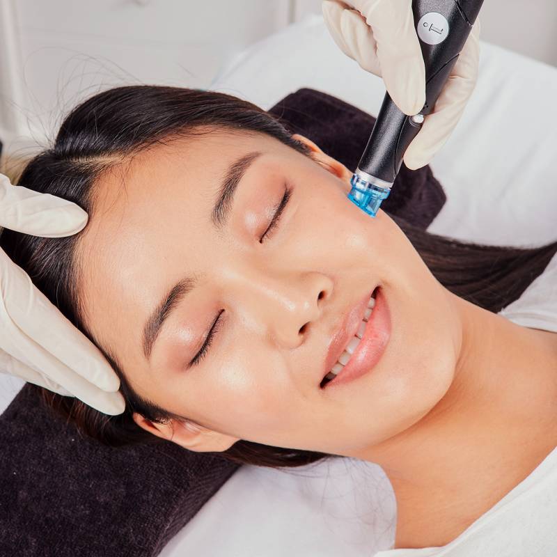 A smiling individual with beautiful, rejuvenated skin; text features a limited-time discount on a skin treatment at Springs Dermatology MD.