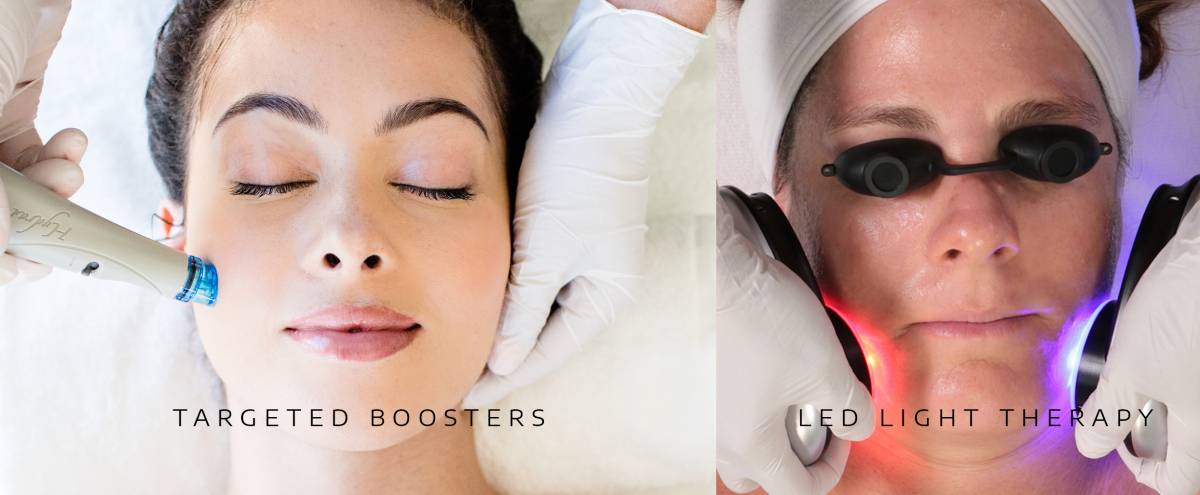 Before and after images showing rejuvenated, healthy skin, highlighting treatment benefits at Springs Dermatology MD.