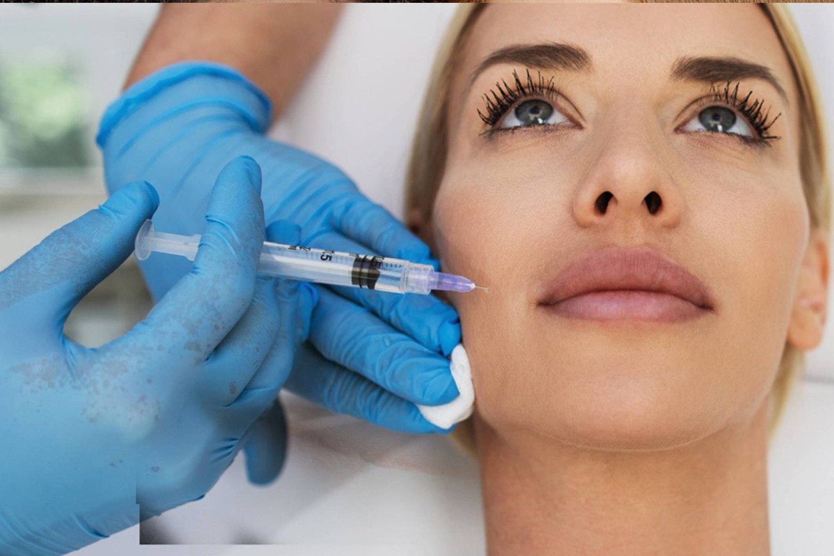 Woman receiving a dermal filler injection to the nasolabial fold (smile lines) in a dermatology clinic.